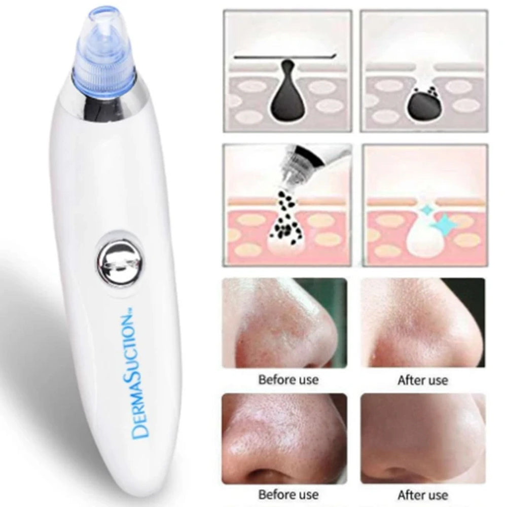 4 in 1 High Quality Black Head Remover Derma Suction Vacuum Suction Face Pore Cleaner Facial Beauty