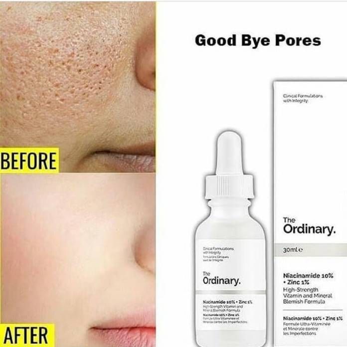 The Ordinary Niacinamide 10%+ Zinc 1% Serum 30ml